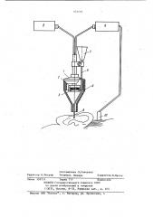 Устройство для лечения среднего и внутреннего уха (патент 931191)