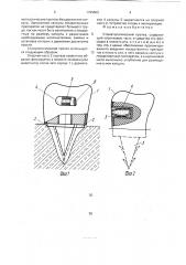 Стоматологический протез (патент 1729503)