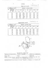 Способ панкреатодуоденальной резекции (патент 1724183)