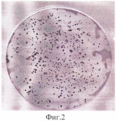 Способ выявления штаммов бактерий-продуцентов l-аспарагиназы (патент 2398876)