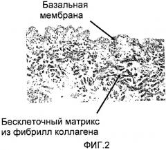 Стерильный аутологичный, аллогенный или ксеногенный имплантат и способ его изготовления (патент 2478403)