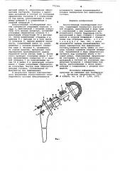 Искусственный тазобедренный сустав (патент 772546)