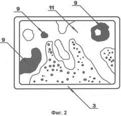 Способ автоматизированной морфометрической диагностики миелофиброза (патент 2552928)
