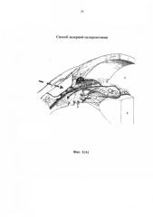 Способ лазерной склерэктомии (патент 2587857)