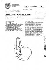 Протез кисти (патент 1362468)