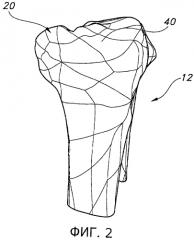 Способы и устройства для артропластики коленного сустава (патент 2570313)