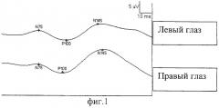 Способ лечения посттравматических зрительных нарушений (патент 2290227)