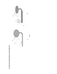 Магнитоуправляемый фаллоэндопротез (патент 2651098)