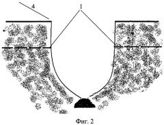 Способ комплексного лечения эпителиального копчикового хода (патент 2444304)
