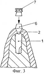 Зубной протез с опорой на имплантат и способ его изготовления (патент 2250088)