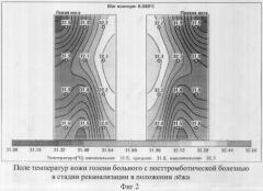Способ комбинированной термометрии для диагностики посттромботической болезни вен нижних конечностей (патент 2319438)