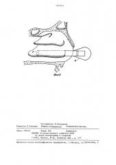 Хирургический инструмент ю.п.богача для удаления гипертрофированной ткани (патент 1337071)