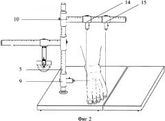 Устройство для измерения размеров голеностопного сустава и стопы (патент 2325108)