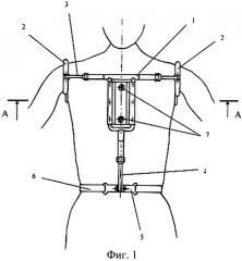Устройство для лечения воронкообразной деформации грудной клетки (патент 2485903)