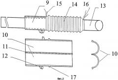 Катетер для удаления контейнеров с тканями из полости кишки при выполнении лапароскопических операций (патент 2304986)
