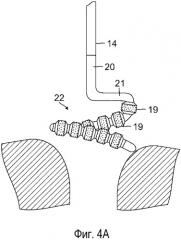 Катетер с регулируемой дугообразной дистальной секцией (патент 2542088)