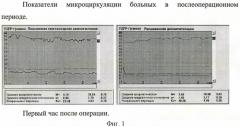 Способ комбинированной десимпатизации у больных с хронической ишемией нижних конечностей (патент 2441603)