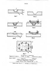 Способ лечения кровоточащих язв желудка и двенадцатиперстной кишки (патент 921529)