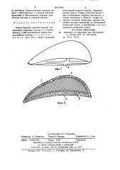 Искусственная грудная железа (патент 891088)