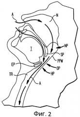 Системы имплантатов и способы лечения обструктивного апноэ во сне (патент 2515765)