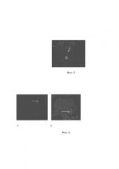 Способ определения контуров миокарда левого предсердия на мр-изображениях с использованием мультипланарных реконструкций (патент 2576816)