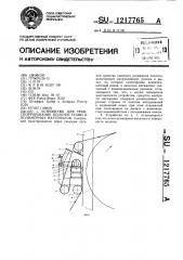 Устройство для транспортирования полотен ткани и полимерных материалов (патент 1217765)