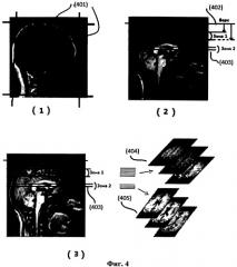 Система и способ для автоматического планирования видов в объемных изображениях мозга (патент 2523929)