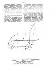 Шина для вытяжения нижней конечности (патент 1175462)