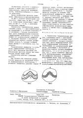 Компенсатор гидравлических ударов (патент 1281806)