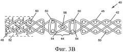 Сшиваемая на машине техническая ткань с кольцами для усиления шва (патент 2320793)