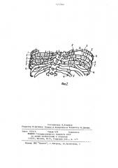 Способ торакопластики при сколиозе (патент 1217388)