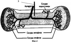 Способ прижизненного забора костного мозга у животных (патент 2290093)