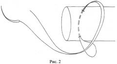Способ наложения сухожильного шва (патент 2500356)