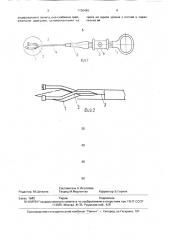 Устройство для полипэктомии к гибким эндоскопам (патент 1736449)