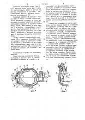 Устройство для фиксирования голеностопной части ноги в лыжном креплении (патент 1243609)