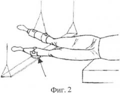 Способ активации двигательных функций человека (патент 2505277)