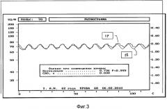 Способ коррекции вегетативного баланса у больных инфарктом миокарда (патент 2465816)