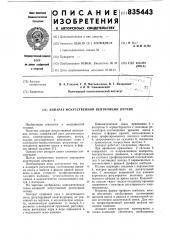 Аппарат искусственной венти-ляции легких (патент 835443)