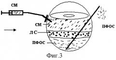 Способ лечения пролиферативной витреоретинопатии (патент 2284812)