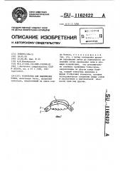 Устройство для выдвижения зубов (патент 1162422)