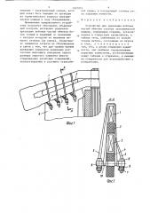 Устройство для крепления лобовых частей обмотки статора электрической машины (патент 1457075)