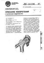 Фиксатор шейки бедренной кости (патент 1311729)