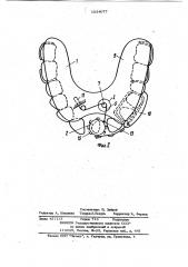 Съемный ортодонтический аппарат (патент 1024077)