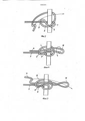 Узел матасова-бутейко с затягивающейся рабочей петлей (патент 1460096)