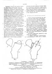 Способ костной аутопластики при ложных суставах шейки бедра (патент 563965)