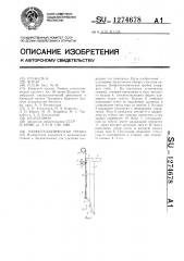 Эзофагоскопическая трубка (патент 1274678)