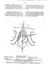 Способ контрастирования венозной системы полового члена (патент 1792648)