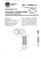 Эндопротез плечевого сустава (патент 1192823)