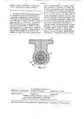 Система смазки кривошипно-шатунного механизма двигателя внутреннего сгорания (патент 1315625)