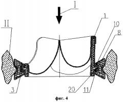 Протез клапана сердца (варианты) (патент 2350300)